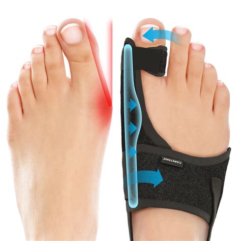 bunion corrector for men|More.